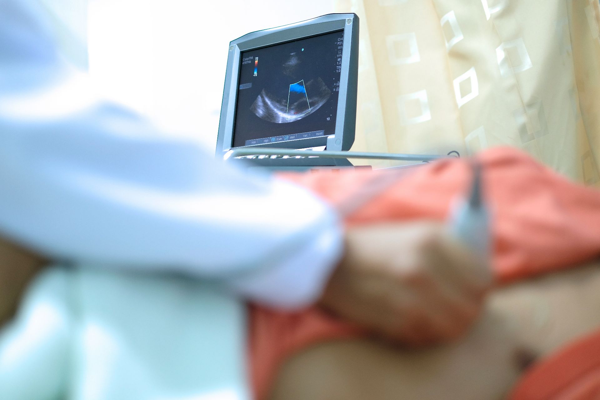 Can I Self Refer for an Echocardiogram (heart scan)?