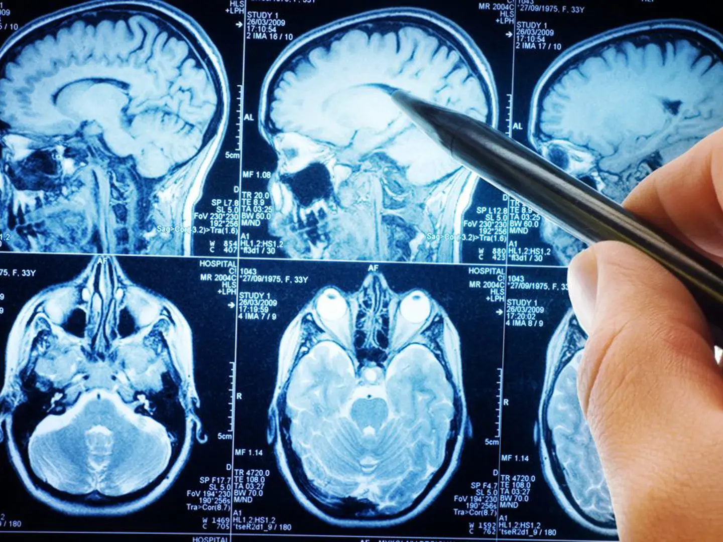 Neuroreader MRI