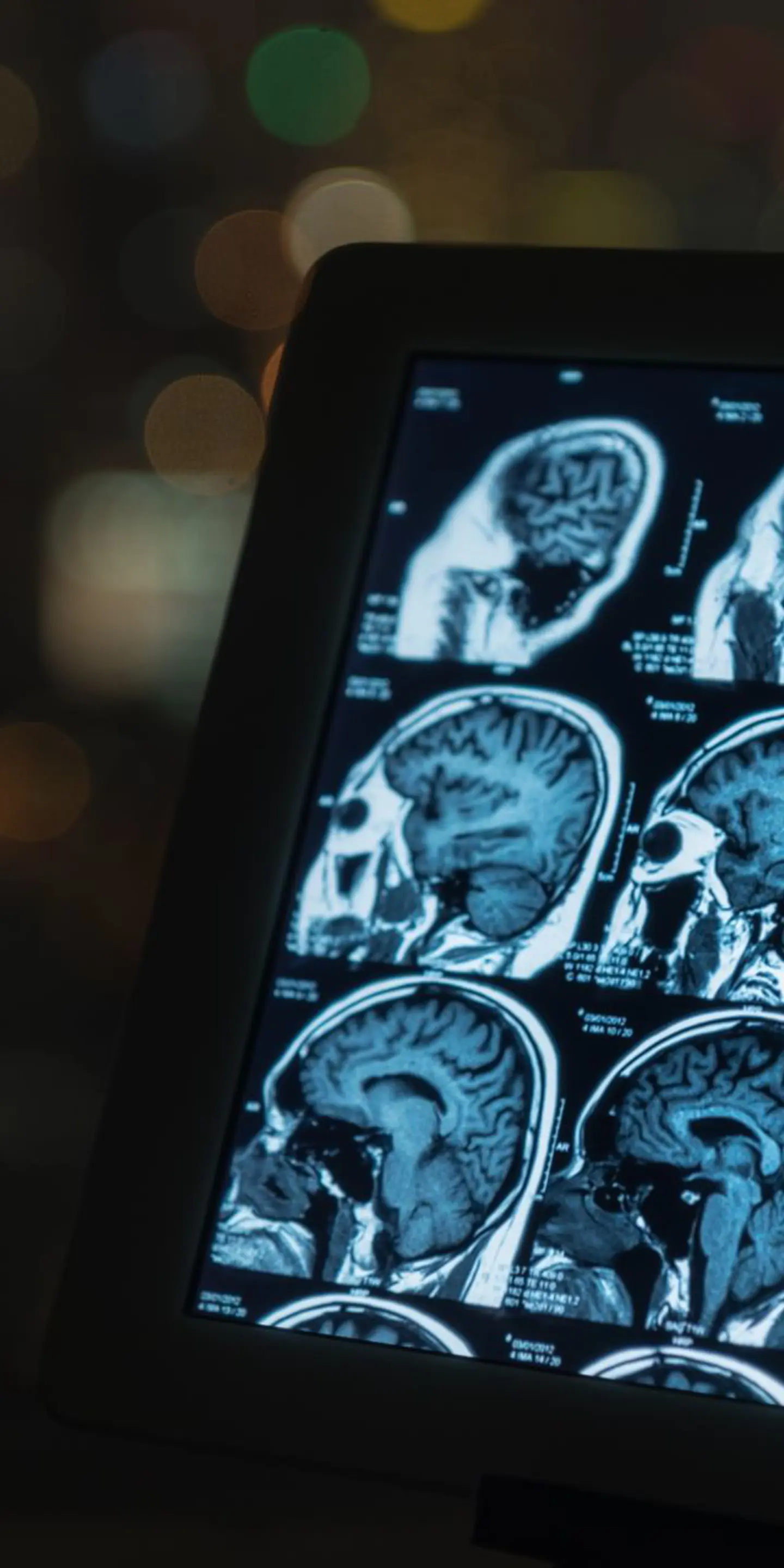 A day in the life of a Radiographer | Vista Health