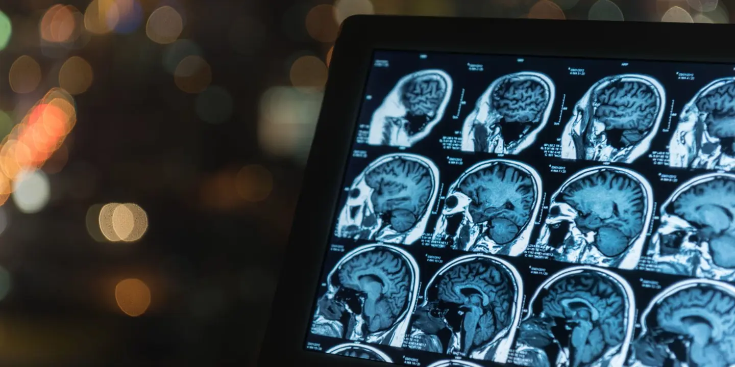 A day in the life of a Radiographer | Vista Health