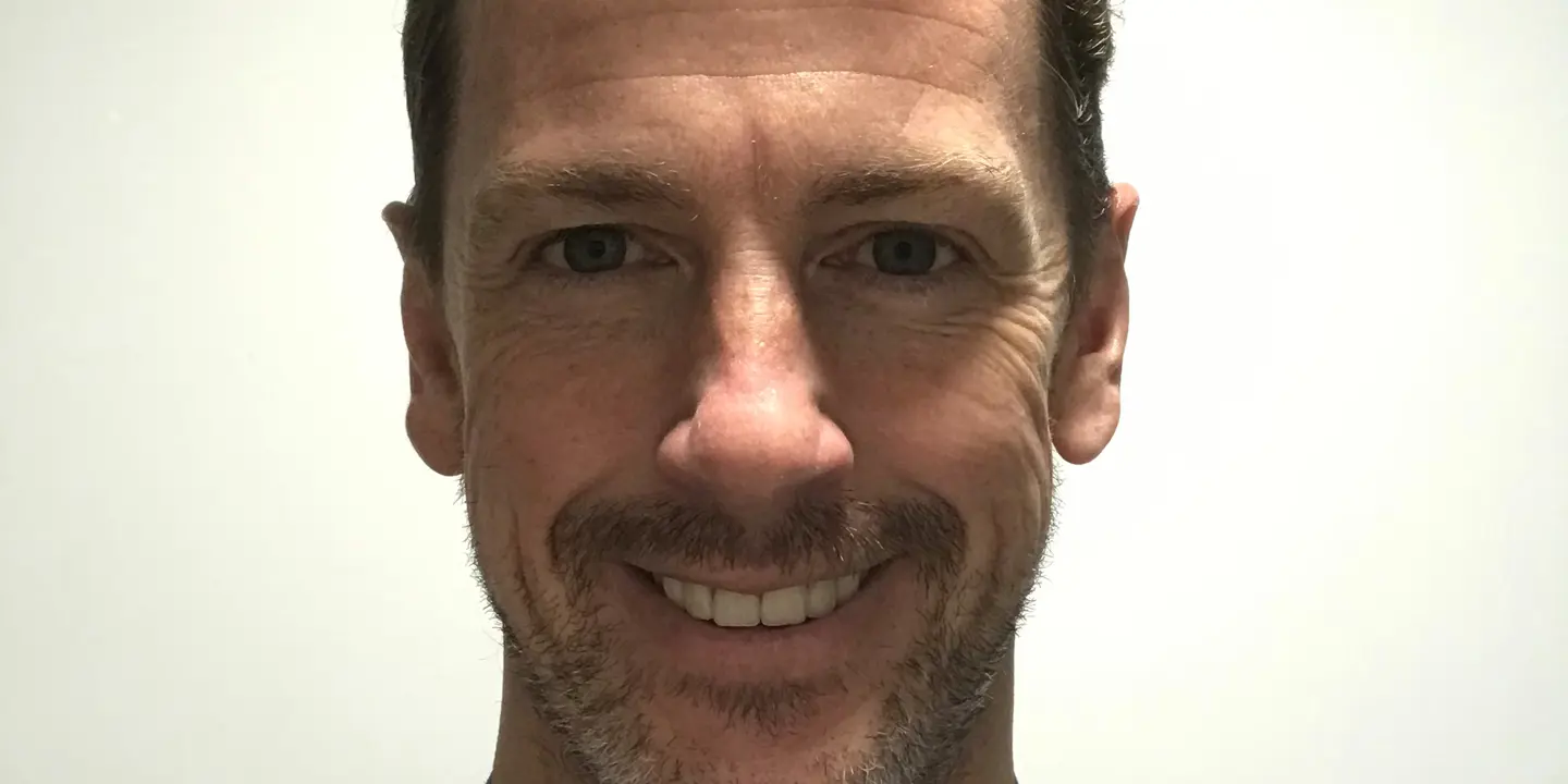 Lister Metcalfe Image