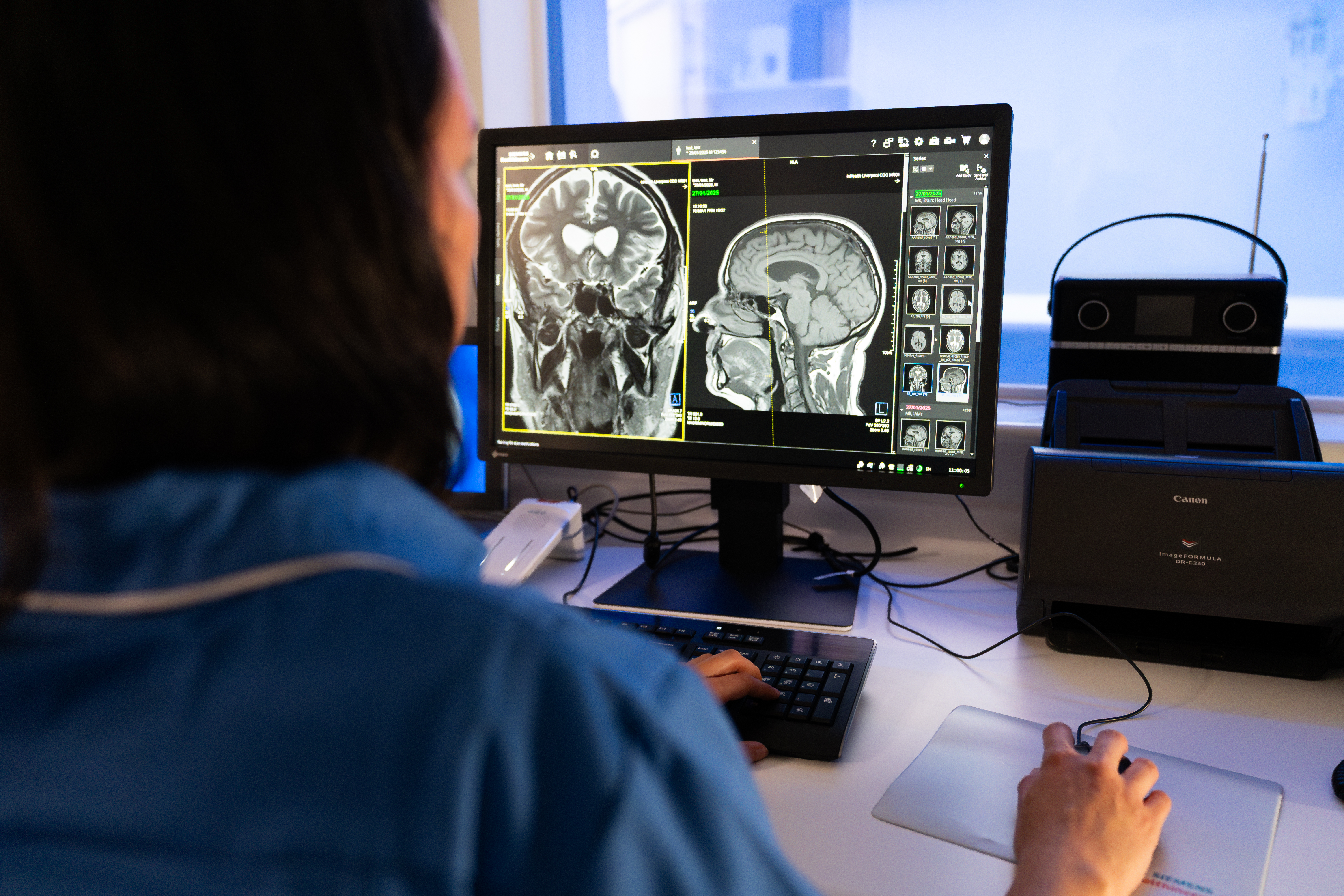Advanced MRI Diagnostic Applications