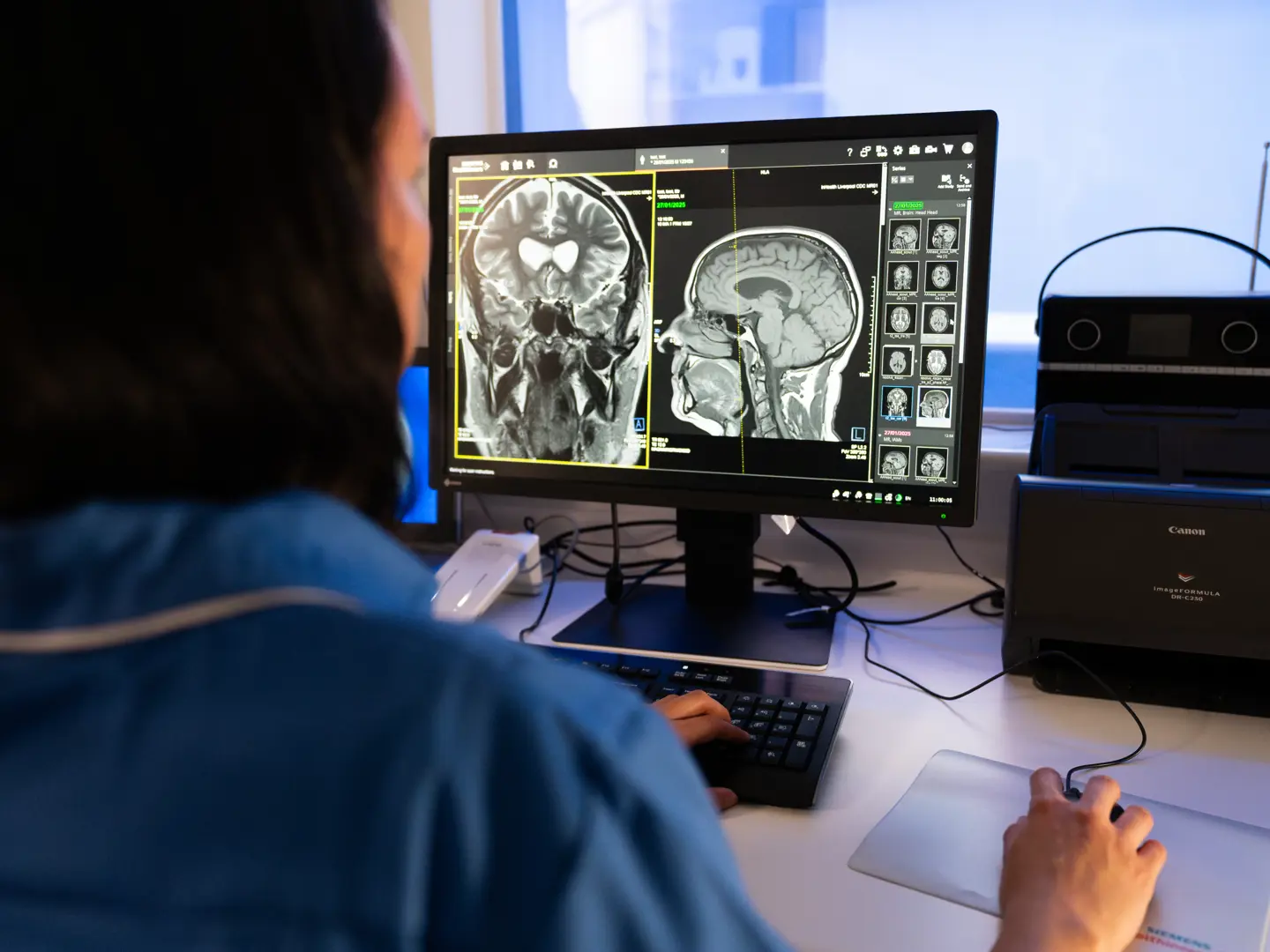 MRI Head