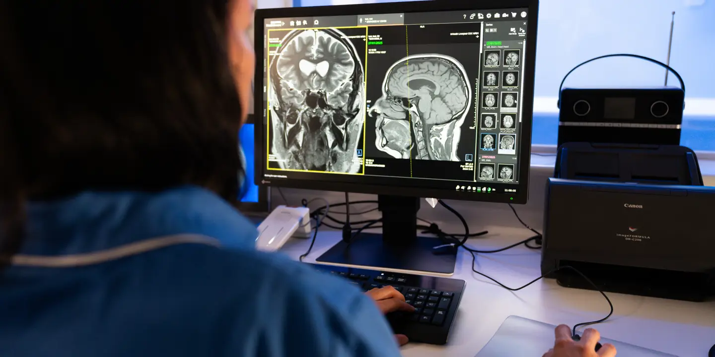 MRI Head