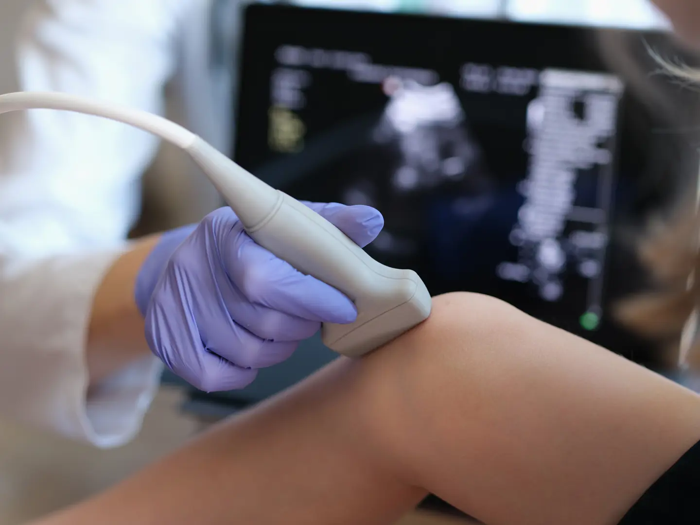 Knee Ultrasound