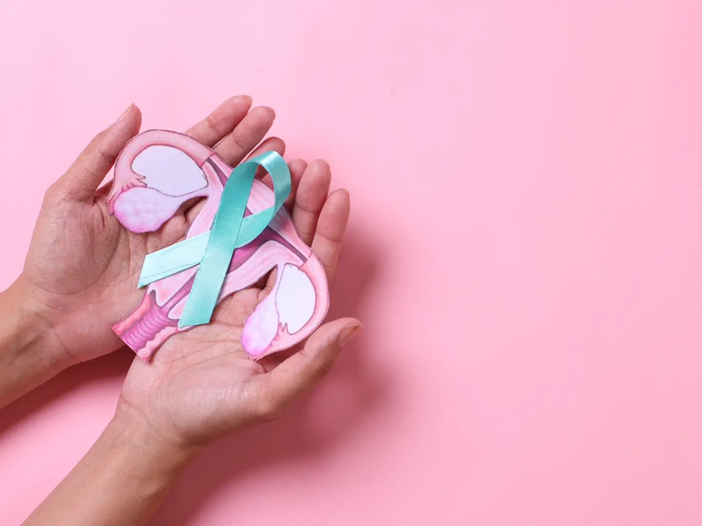 Ovarian Cancer