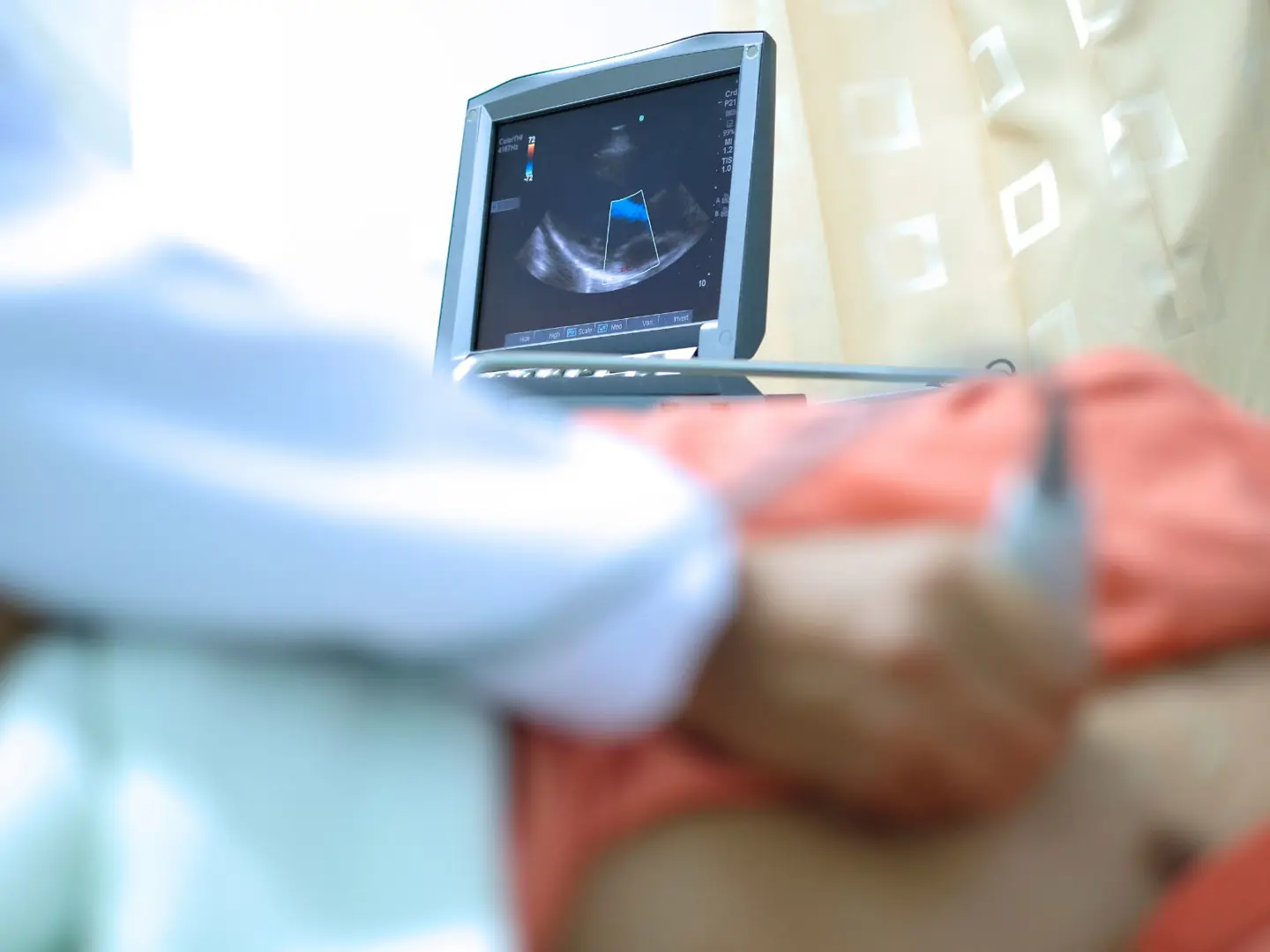 Echocardiography