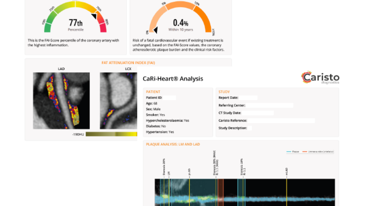 Caristo Analysis Reports