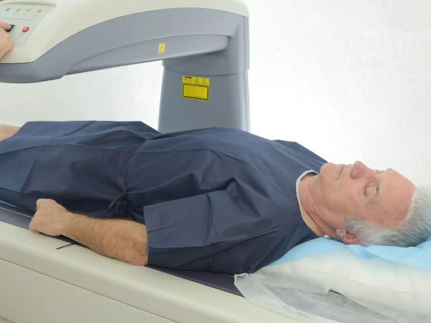 DEXA