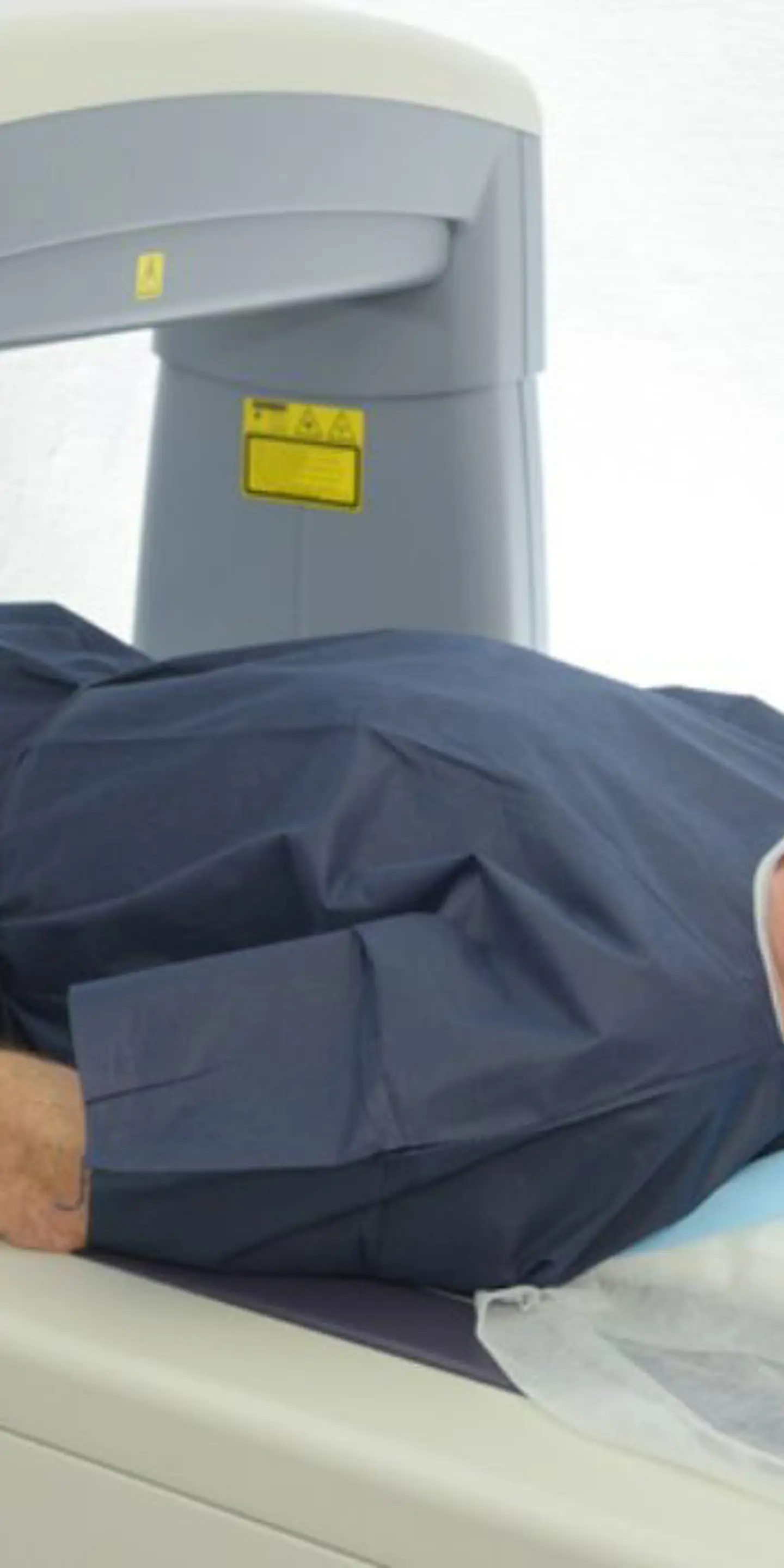 DEXA