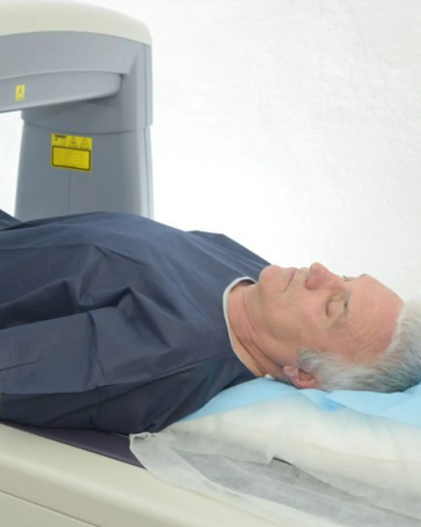 DEXA